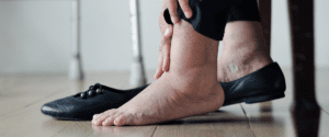 how to get rid of cankles