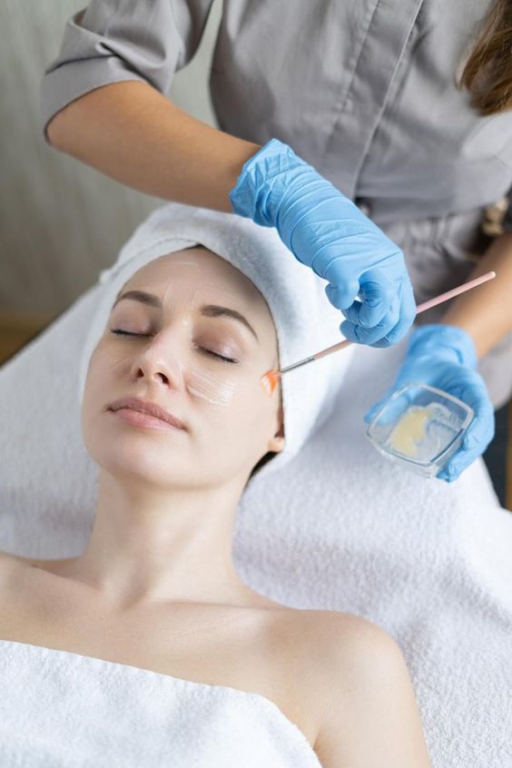 how much does a chemical peel cost